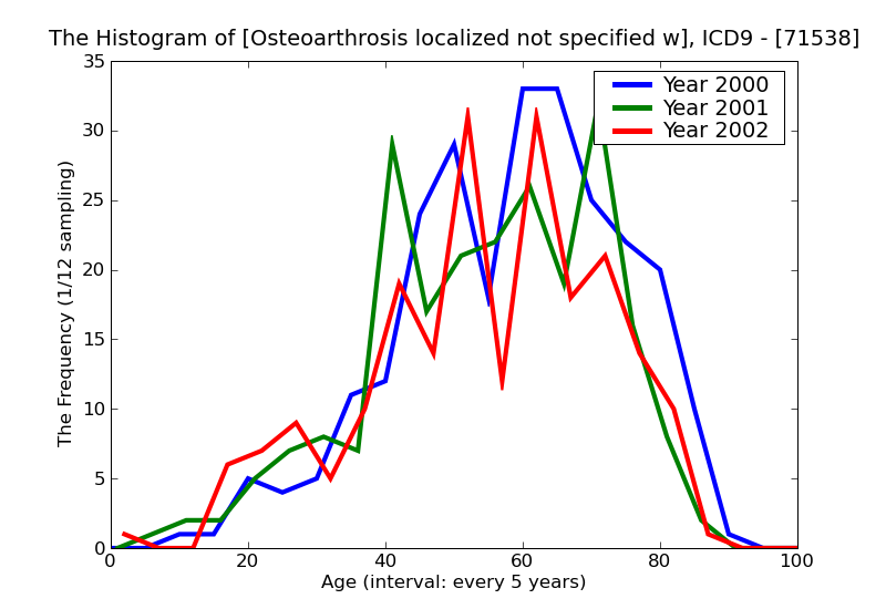 ICD9 Histogram Osteoarthrosis localized not specified whether primary or secondary other specified sites