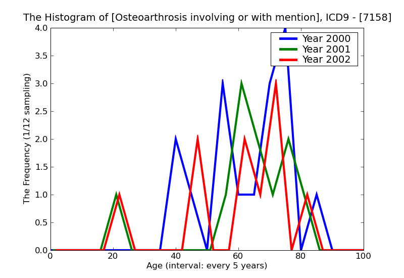 ICD9 Histogram Osteoarthrosis involving or with mention of more than one site but not specified as generalized