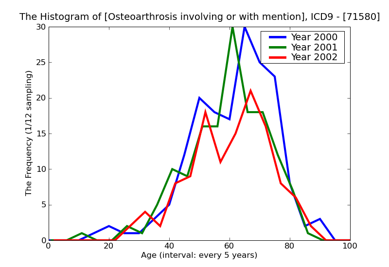 ICD9 Histogram Osteoarthrosis involving or with mention of more than one site but not specified as generalized unsp