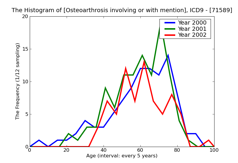 ICD9 Histogram Osteoarthrosis involving or with mention of more than one site but not specified as generalized mult