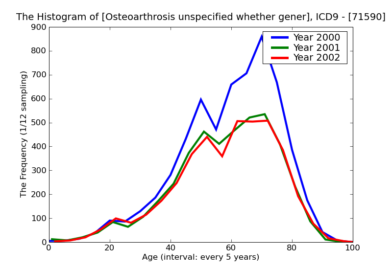 ICD9 Histogram Osteoarthrosis unspecified whether generalized or localized unspecified site