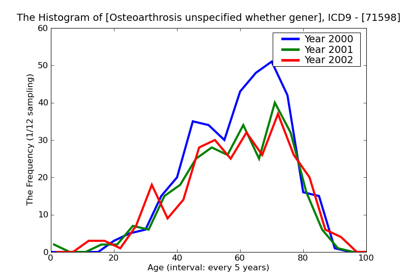 ICD9 Histogram Osteoarthrosis unspecified whether generalized or localized other specified sites