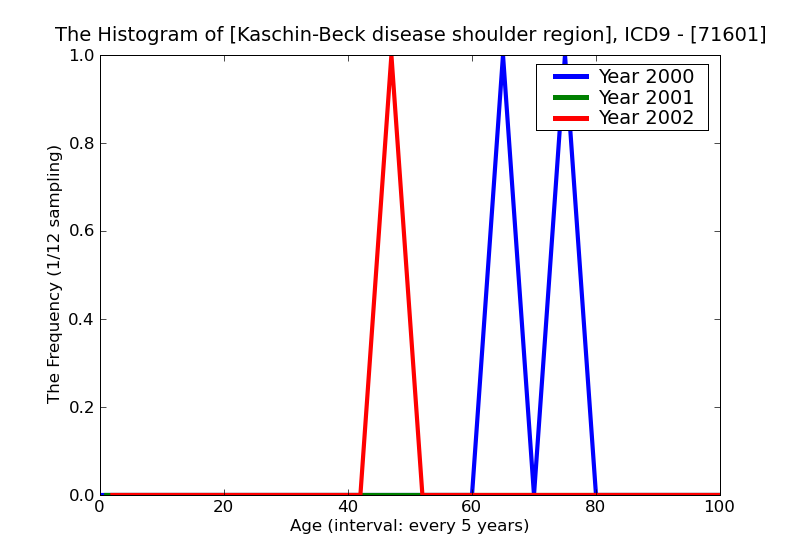 ICD9 Histogram Kaschin-Beck disease shoulder region