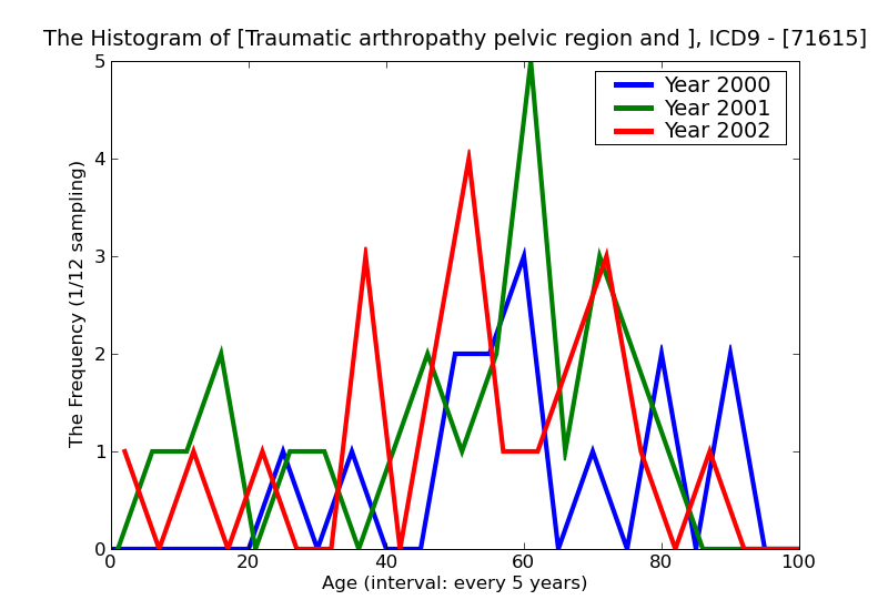 ICD9 Histogram Traumatic arthropathy pelvic region and thigh