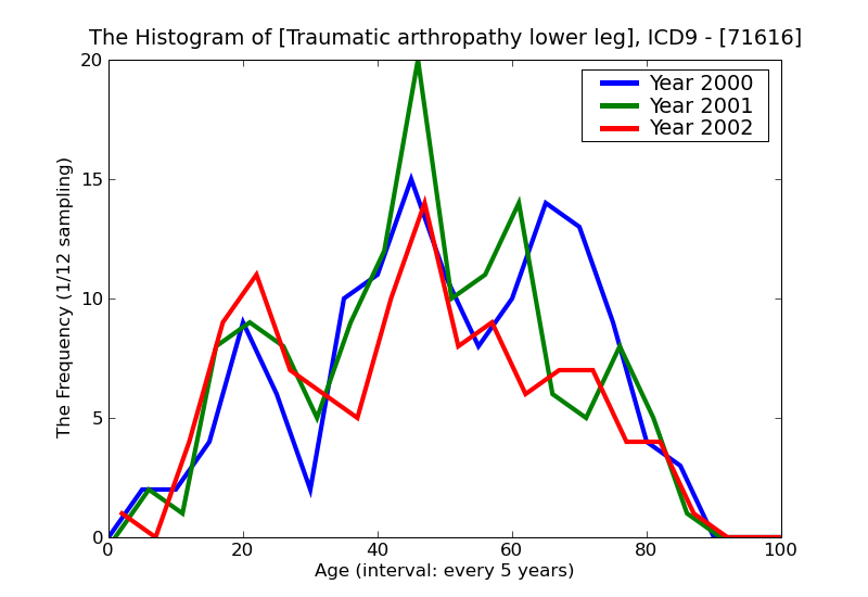 ICD9 Histogram Traumatic arthropathy lower leg