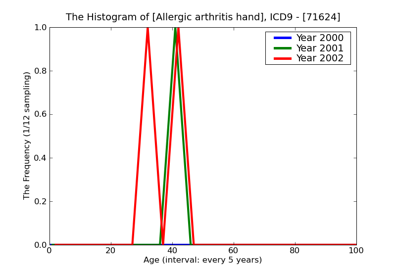 ICD9 Histogram Allergic arthritis hand