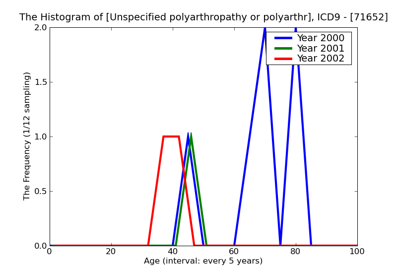 ICD9 Histogram Unspecified polyarthropathy or polyarthritis upper arm