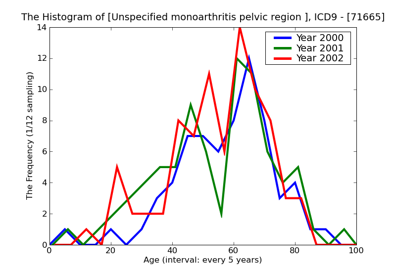 ICD9 Histogram Unspecified monoarthritis pelvic region and thigh