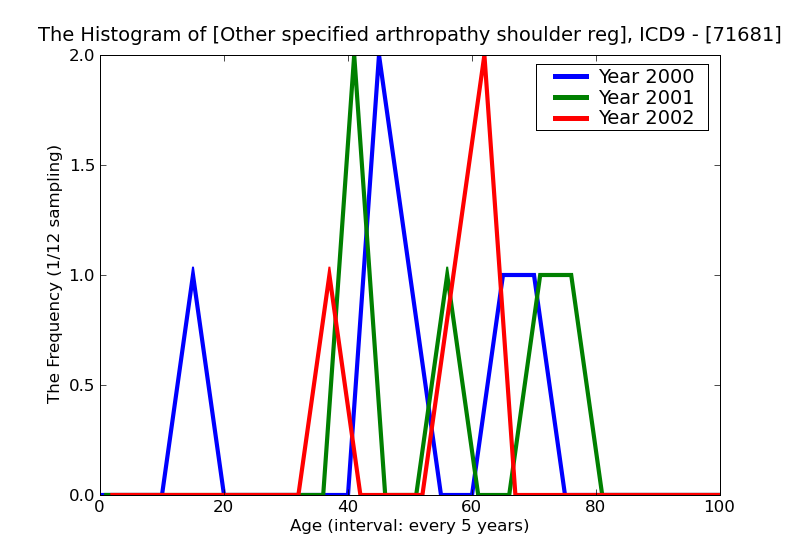 ICD9 Histogram Other specified arthropathy shoulder region