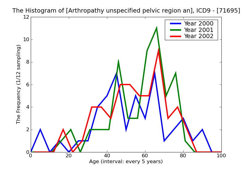 ICD9 Histogram Arthropathy unspecified pelvic region and thigh