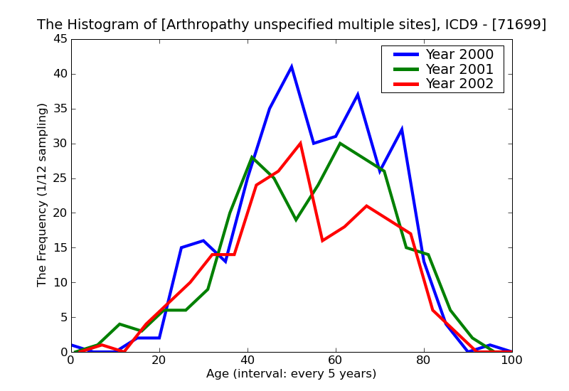 ICD9 Histogram Arthropathy unspecified multiple sites