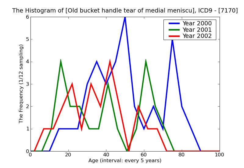 ICD9 Histogram Old bucket handle tear of medial meniscus