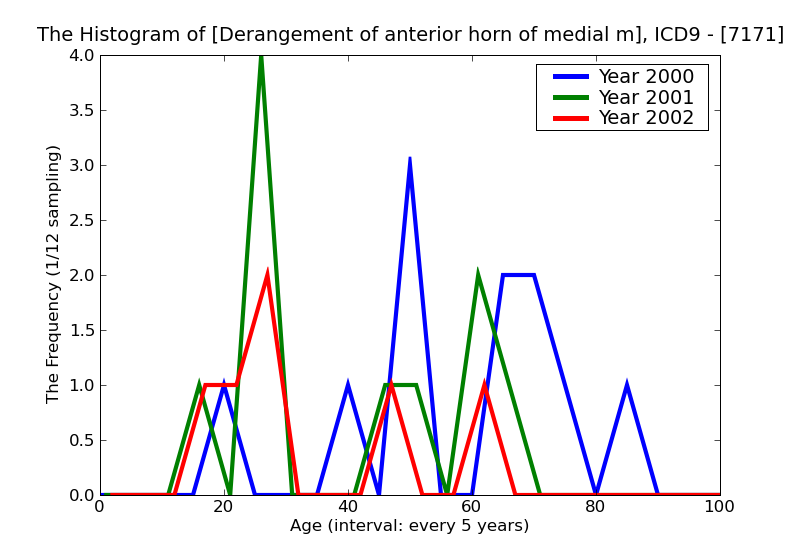 ICD9 Histogram Derangement of anterior horn of medial meniscus