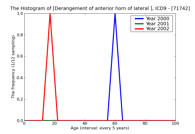 ICD9 Histogram Derangement of anterior horn of lateral meniscus