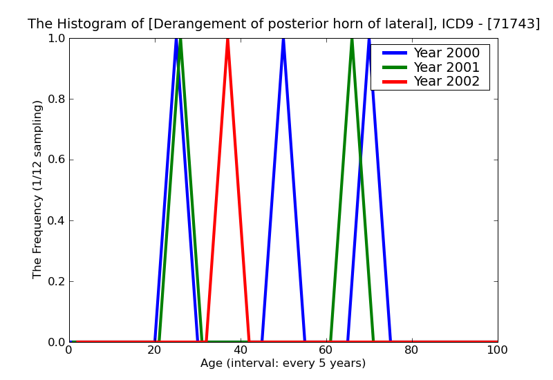 ICD9 Histogram Derangement of posterior horn of lateral meniscus