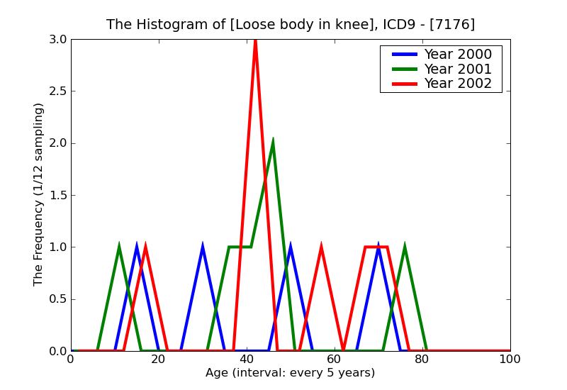 ICD9 Histogram Loose body in knee