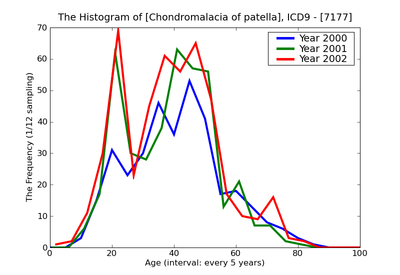 ICD9 Histogram Chondromalacia of patella