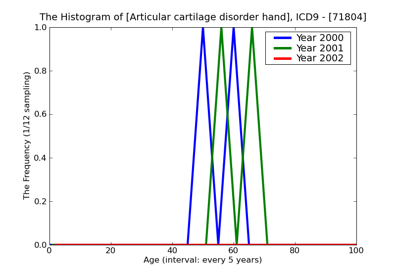 ICD9 Histogram Articular cartilage disorder hand