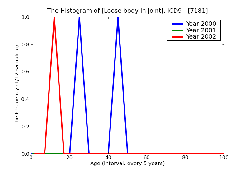 ICD9 Histogram Loose body in joint