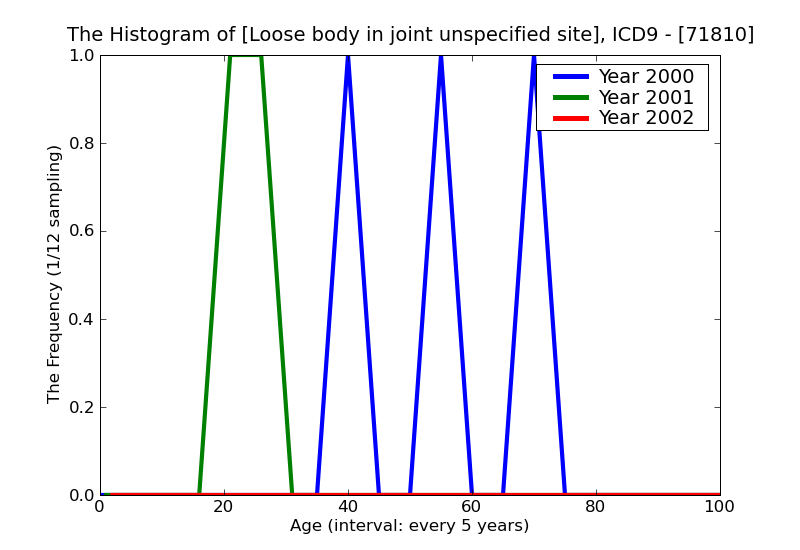 ICD9 Histogram Loose body in joint unspecified site