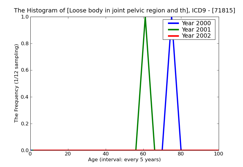 ICD9 Histogram Loose body in joint pelvic region and thigh