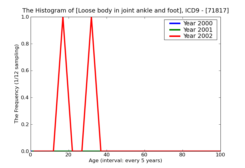 ICD9 Histogram Loose body in joint ankle and foot