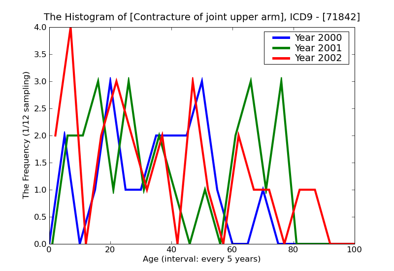ICD9 Histogram Contracture of joint upper arm