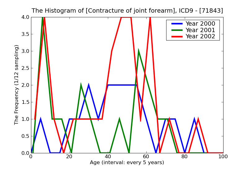 ICD9 Histogram Contracture of joint forearm