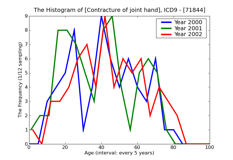 ICD9 Histogram Contracture of joint hand