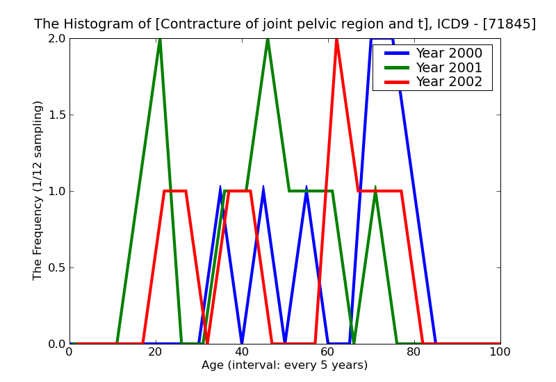 ICD9 Histogram Contracture of joint pelvic region and thigh