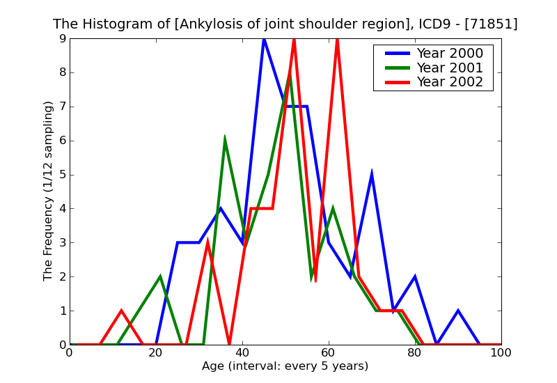 ICD9 Histogram Ankylosis of joint shoulder region