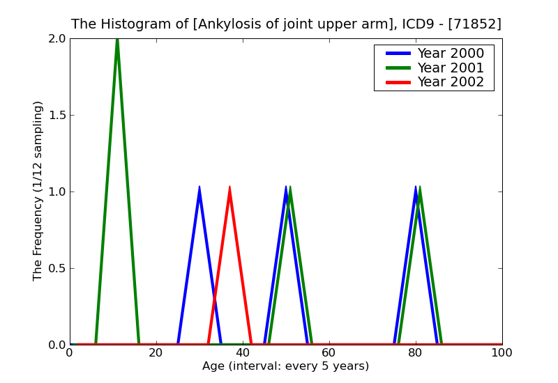 ICD9 Histogram Ankylosis of joint upper arm