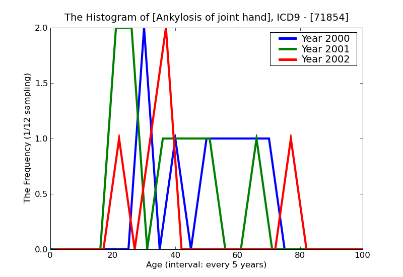 ICD9 Histogram Ankylosis of joint hand