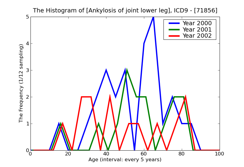 ICD9 Histogram Ankylosis of joint lower leg