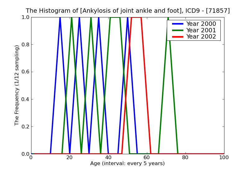 ICD9 Histogram Ankylosis of joint ankle and foot