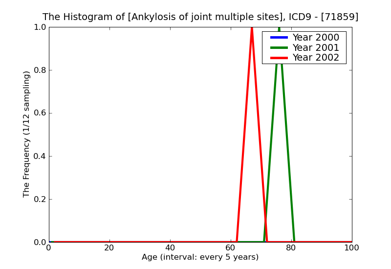 ICD9 Histogram Ankylosis of joint multiple sites