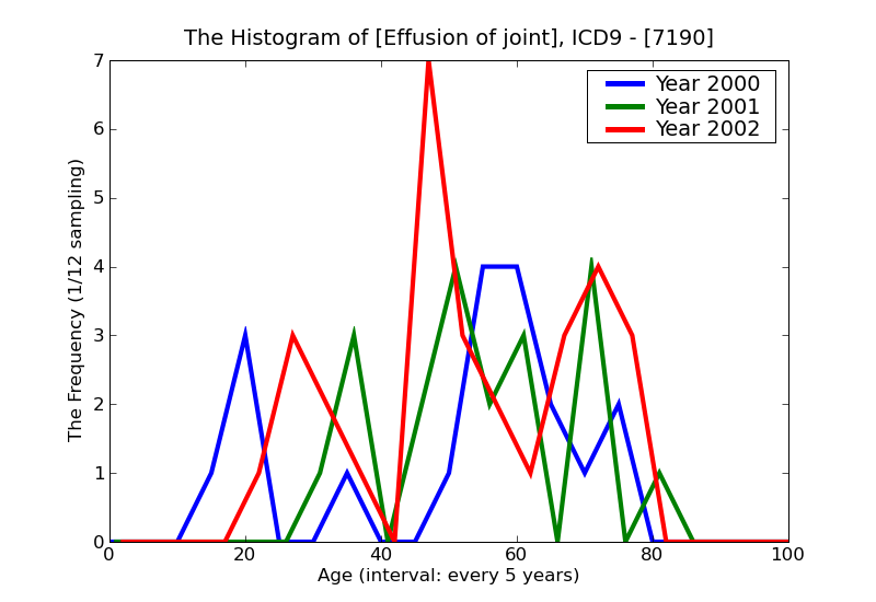 ICD9 Histogram Effusion of joint