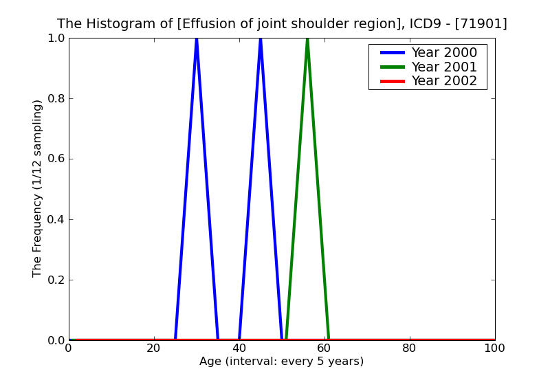 ICD9 Histogram Effusion of joint shoulder region