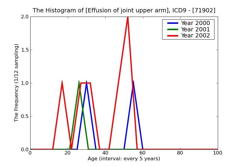 ICD9 Histogram Effusion of joint upper arm