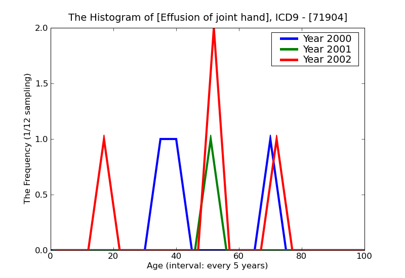 ICD9 Histogram Effusion of joint hand