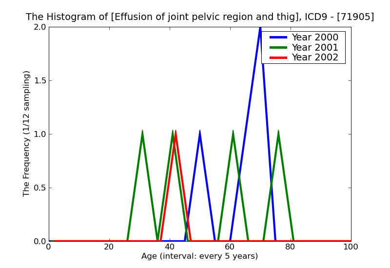 ICD9 Histogram Effusion of joint pelvic region and thigh