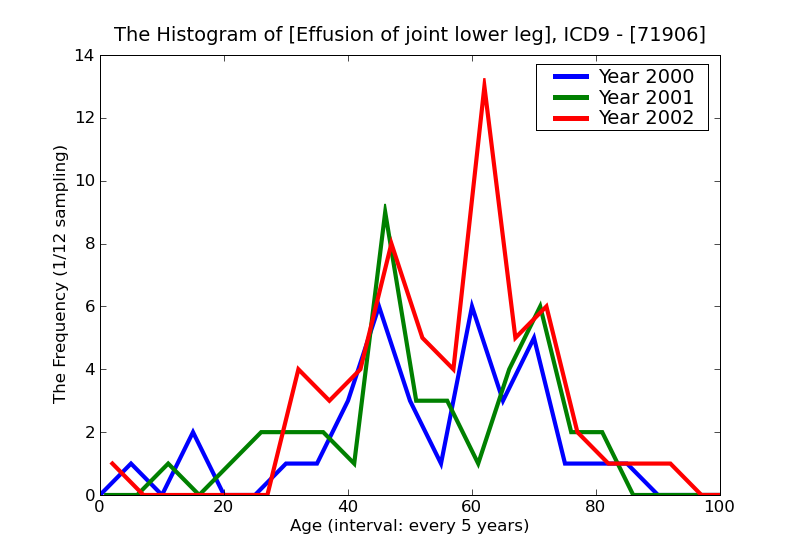 ICD9 Histogram Effusion of joint lower leg