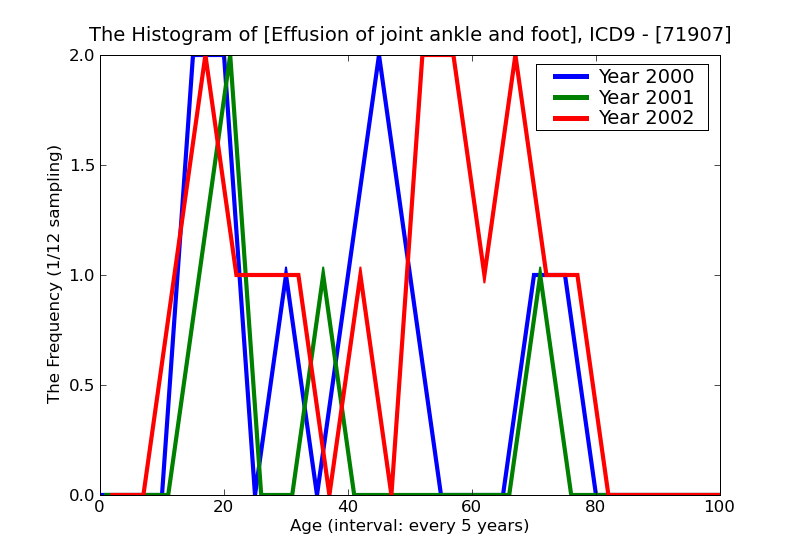 ICD9 Histogram Effusion of joint ankle and foot