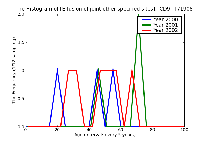ICD9 Histogram Effusion of joint other specified sites