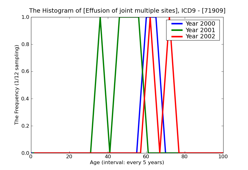 ICD9 Histogram Effusion of joint multiple sites
