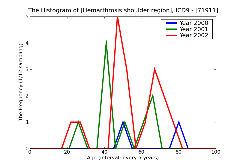 ICD9 Histogram Hemarthrosis shoulder region