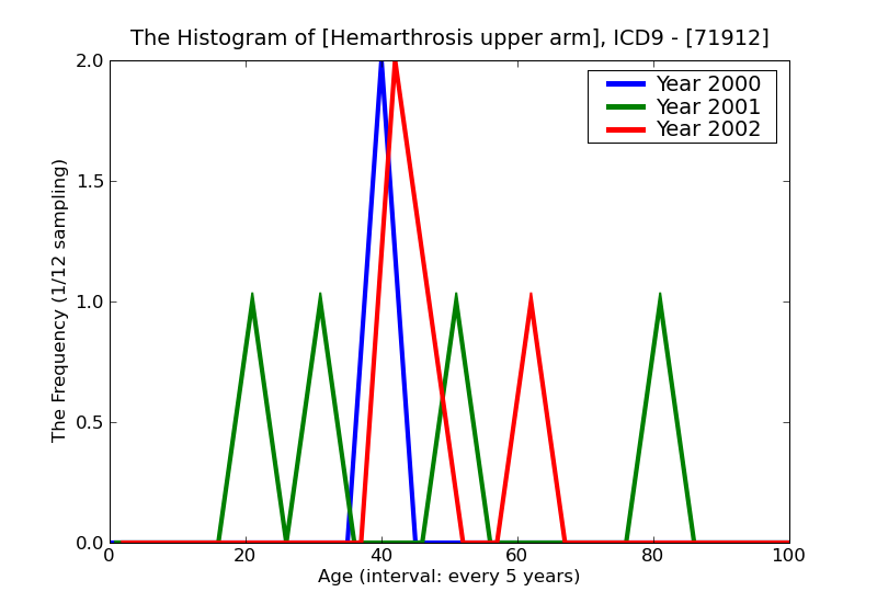 ICD9 Histogram Hemarthrosis upper arm