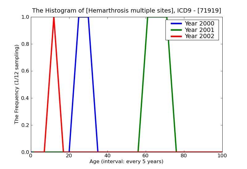 ICD9 Histogram Hemarthrosis multiple sites