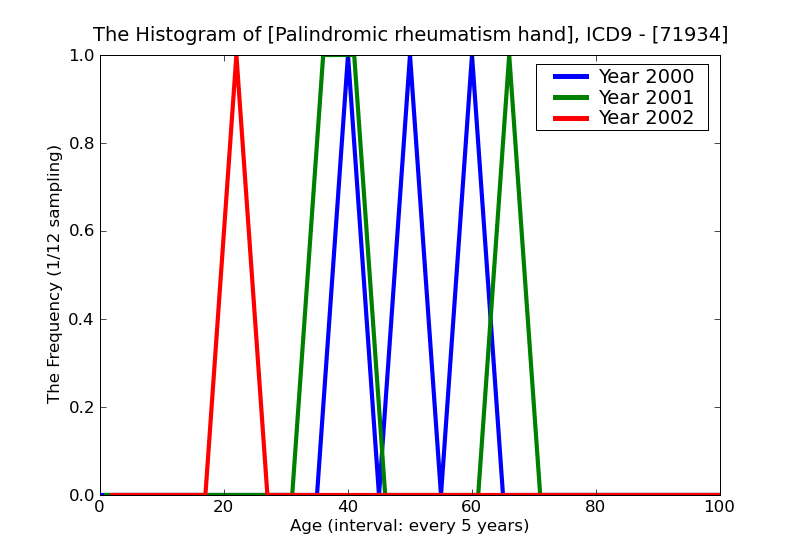 ICD9 Histogram Palindromic rheumatism hand