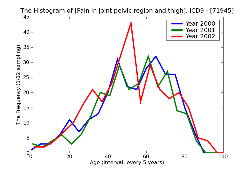 ICD9 Histogram Pain in joint pelvic region and thigh